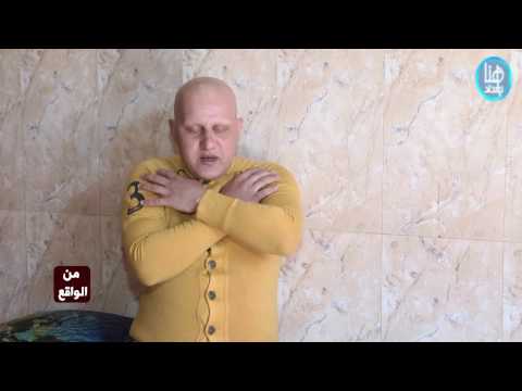 علي عذاب حلقة كامله عن قصة الشاب علي الذي سقط شعرة واسنانه بسبب الحب حلقة مخيفة فقط