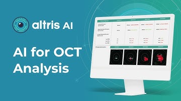 AI for Clinical Trials