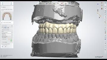 3Shape Design Service - Simple Upload Workflow