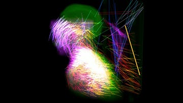 Pymedix Autofuse: automated deformable medical image registration