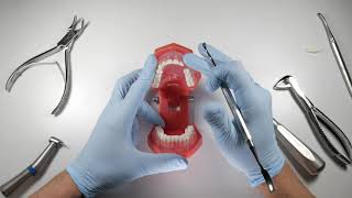 How To Manage A Broken Buccal Plate During An Extraction | OnlineExodontia.com