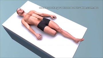 OGAP OPL   Prosthesis System