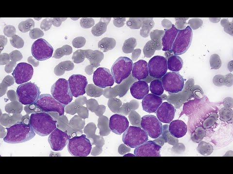 Infecciones maternas y