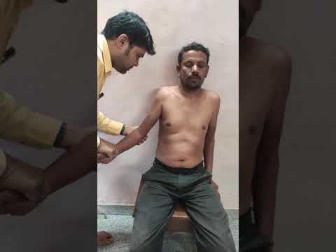 Reduction of Anterior Shoulder Joint Dislocation by modified Kocher's method by Dr.R.S.G. MS(PhD)Ay.
