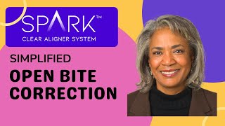 Spark Clear Aligners Simplified Open Bite Correction