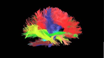 Major white matter bundles in the human brain