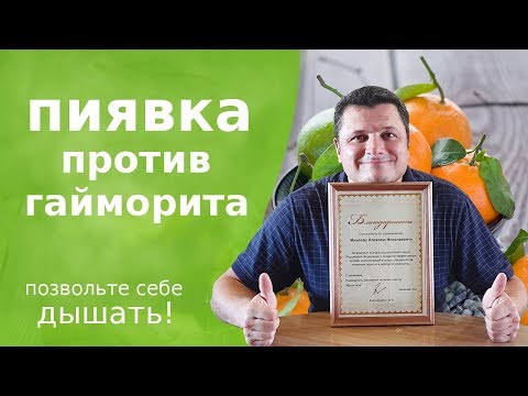 ПИЯВКА  на слизистую носа. ГАЙМОРИТ, ФРОНТИТ уйдут через несколько дней!