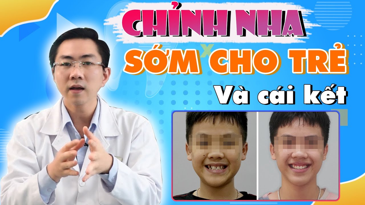 Outline Video Niềng Răng Sớm Cho Trẻ & Hiệu Quả Bất Ngờ! | Nam Bùi Vinalign