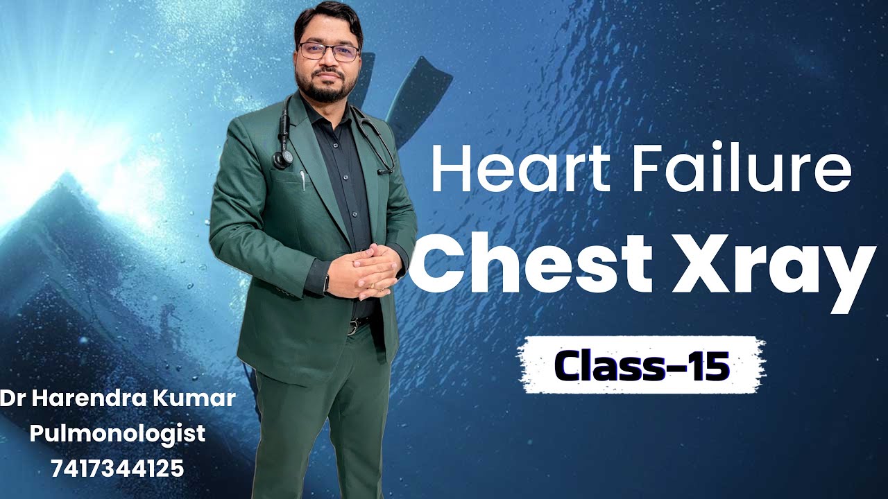 Heart Failure Chest Xray Classes #15 