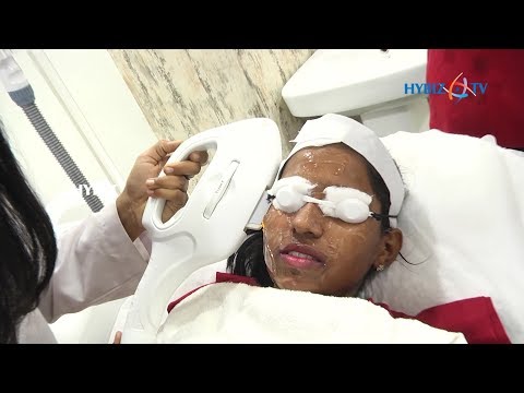 Skin Rejuvenation Laser Treatment | Photofacial @ ABC Clinic