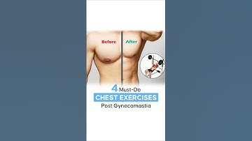 4 Must Do Chest Exercises After Gynecomastia Surgery #shortsvideo