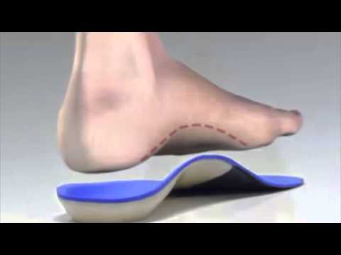 Bunions and Bunion