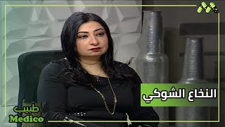 إصابات النخاع الشوكي أعراضها وأسبابها وطرق العلاج مع د. رانيا السيد