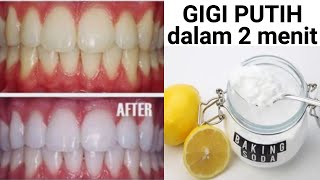 Cara cepat memutihkan gigi | Cara menghilangkan karang gigi secara alami