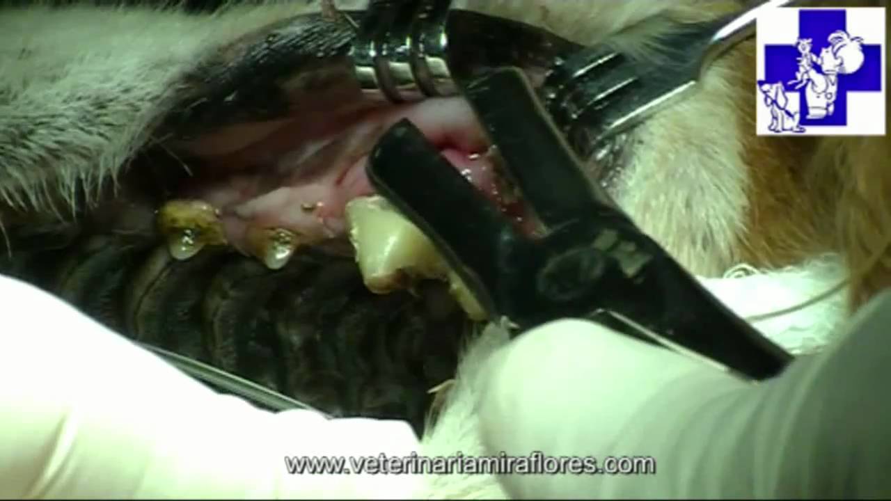 réplica acceso yeso Extracción Muela Carnicera por Fístula. Cirugía Miraflores del Palo -  YouTube
