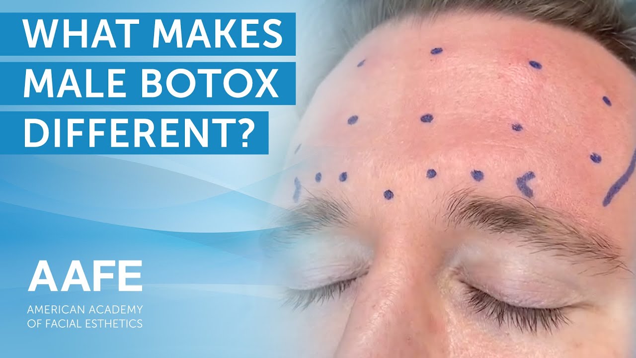 What Makes Male Botox Different?