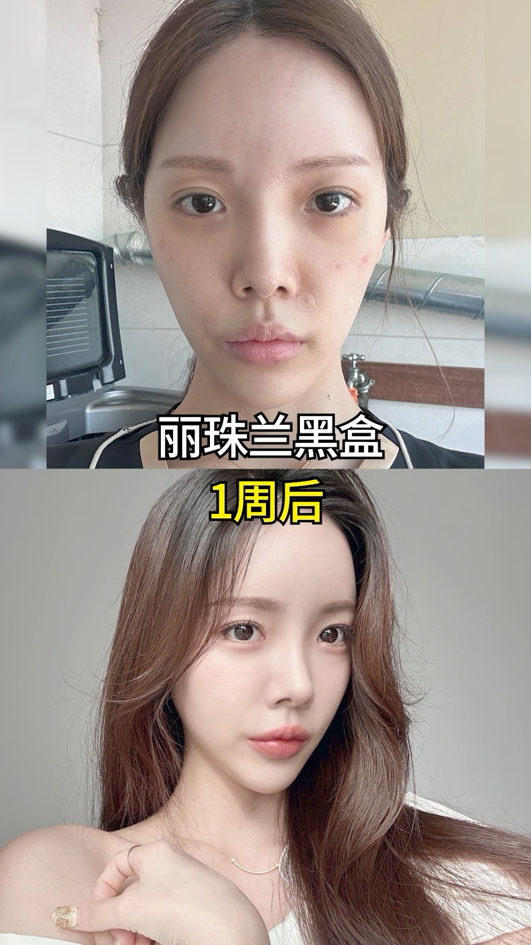 只靠這個療程，肌膚真的發光了！ #shorts