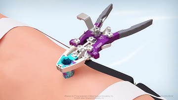 Phantom XL3 Lateral Lumbar Surgical Access System