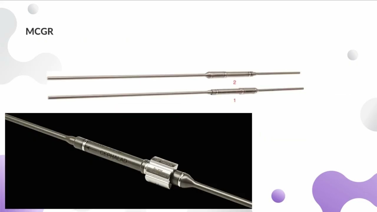 22. SPONTANEOS BONE BLOCK IN EARLY ONSET SCOLIOSIS SURGERY. A PROBLEM WITHIN A PROBLEM