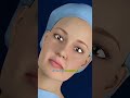 Kidney Stone Removal: How Doctors Fix It! 🏥💎 #Shorts 🇱🇷
