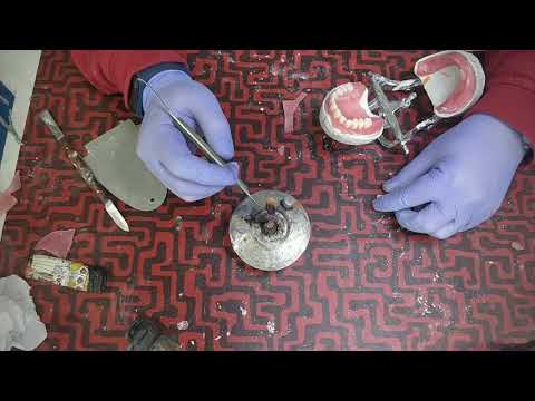 Video: Cum folosiți un set de reparații pentru danturi și dinguri?