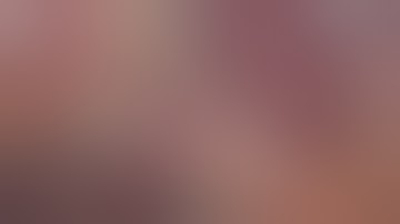 Laparoscopic right hepatectomy