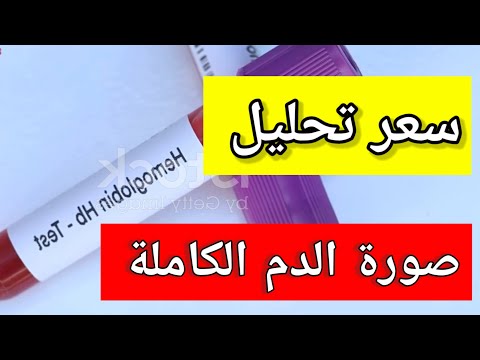 أسعار تحليل  سعر تحليل صورۃ الدم كاملة تكلفة تحليل  ما هو تحليل 