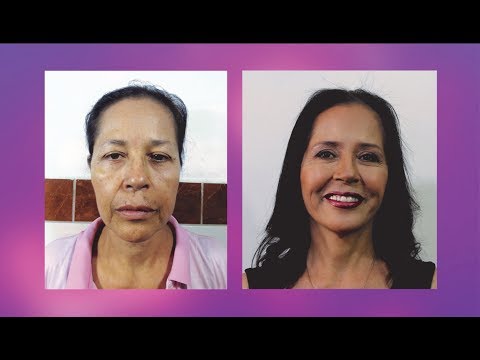 Video: Rejuvenecimiento Rápido: Los Tipos De Estiramiento Facial Más Seguros