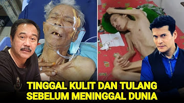 Sangat Miris, Tubuh 7 Artis Ini HanyaTinggal Kulit Dan Tulang Sebelum Meninggal Dunia