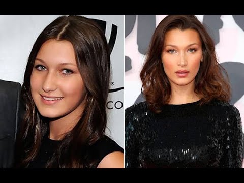 ვაშორებ ბელა ჰადიდს პლასტიკურ ოპერაციებს