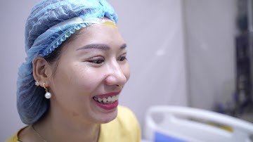 Kết quả sau khi cắt mí Mani Open Deep 5D