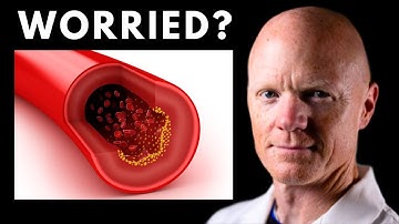 Should you be Worried about your high LDL cholesterol ? Dr. Ben Bikman