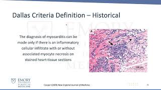 Hearts on Fire - Cases of Fulminant Myocarditis