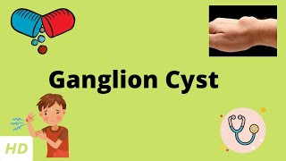 Ganglion Cyst, Causes, Sign and Symptoms, Diagnosis and Treatment.