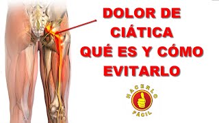 DOLOR DE CIÁTICA - QUÉ ES Y CÓMO EVITARLO