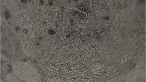 Mouse heart uses human cells to beat again