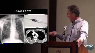 Chest Imaging - Dr. Jack Parker
