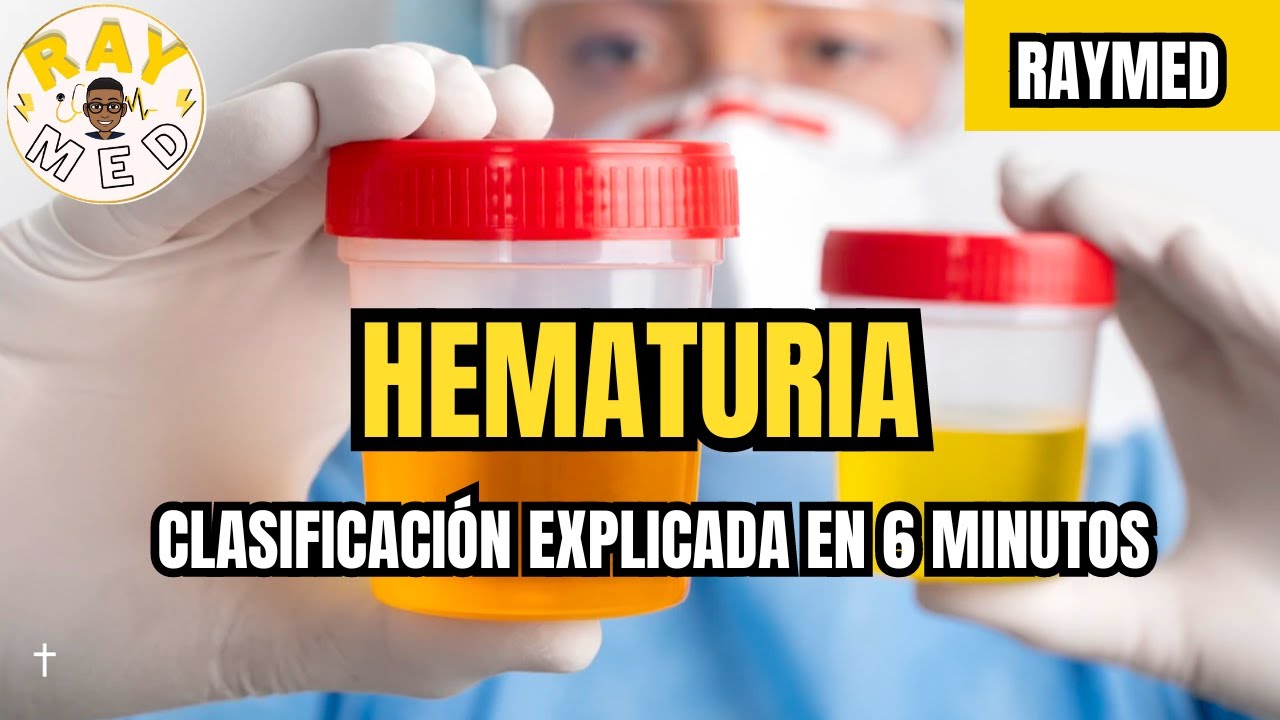 CLASIFICACIÓN DE LA HEMATURIA | URGENCIAS MÉDICAS