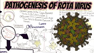 RotaVirus pathophysiology Management Sign Symptoms @umerfarooqbiology7083