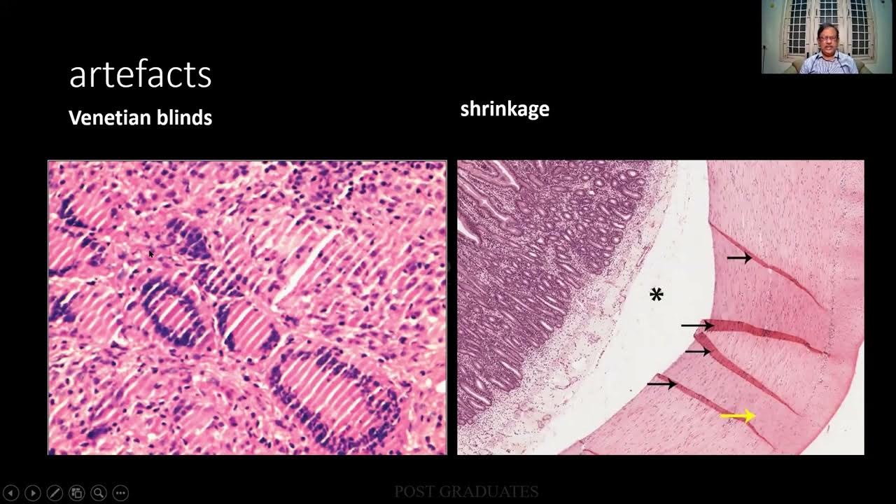 EXAMHistopathology Techniques FIXATIVES PART II MD / DNB Pathology
