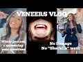 Porcelain Veneers Vlog - No "Sharkfin" teeth! No Damage!