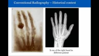 Introduction to Radiology: Conventional Radiography