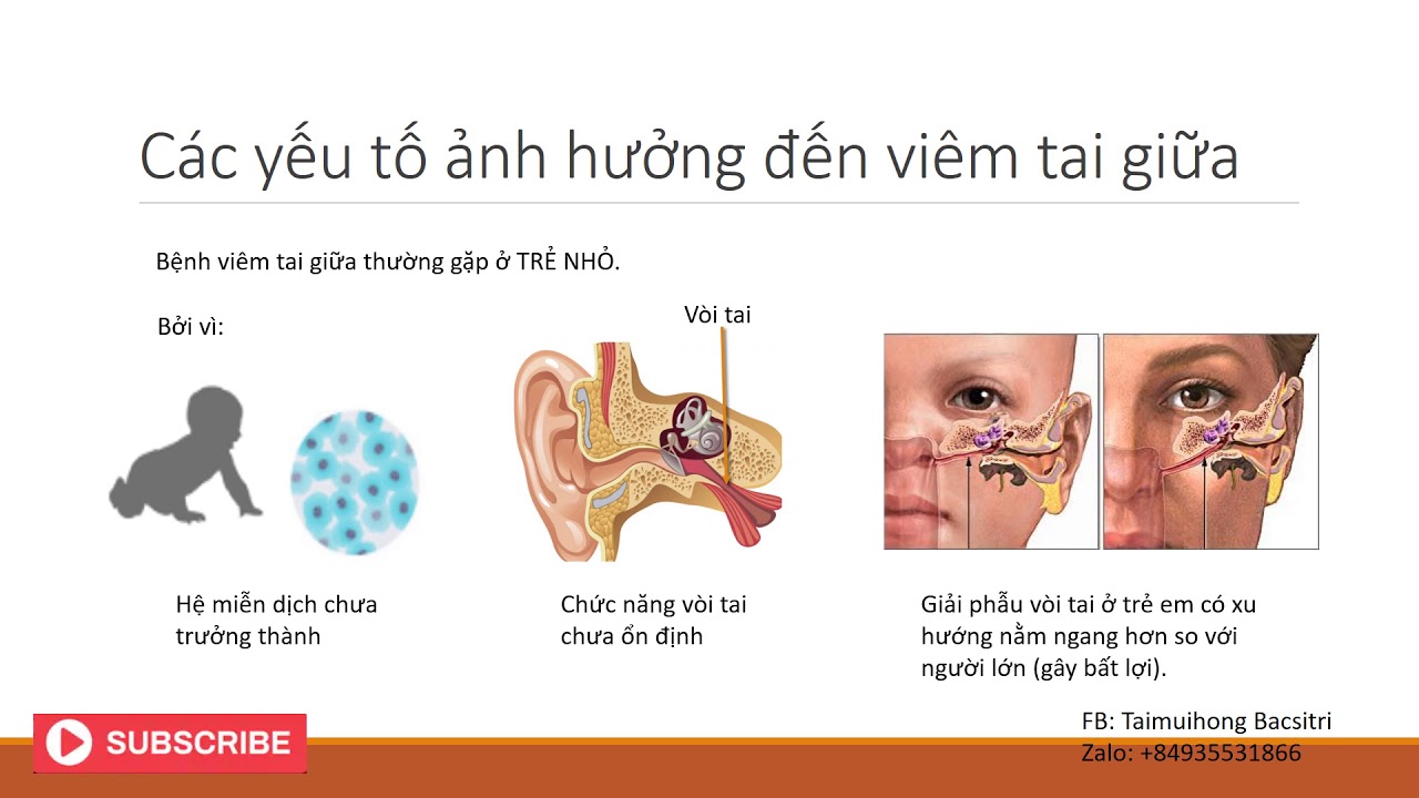 Viêm tai giữa là gì? Các yếu tố nguy cơ - YouTube