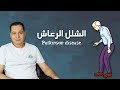 Parkinson S Disease 