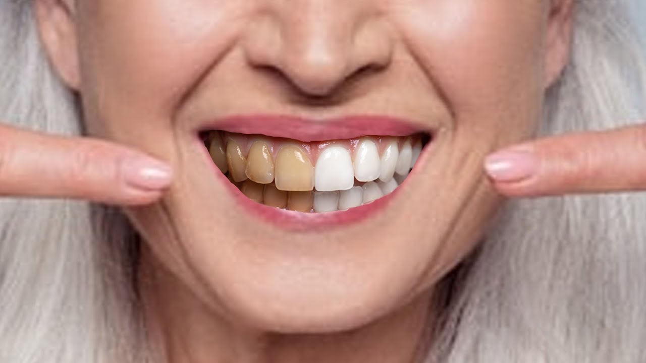 11 Natural Ways to Whiten Teeth at Any Age