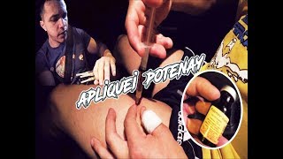 APLIQUEI POTENAY PELA PRIMEIRA VEZ