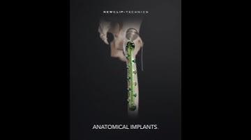 Xpert PFP - Treating periprosthetic fractures of the femur.  #medicaleducation #anatomy #medtech