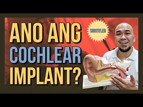 Ano Ba Ang Cochlear Implant?