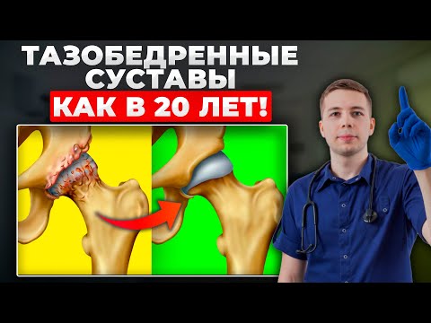 Главный СЕКРЕТ лечения коксартроза БЕЗ ОПЕРАЦИИ! ПРОСТОЙ способ лечения тазобедренного сустава...
