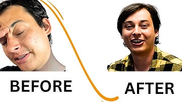 TMS Therapy Before and After - Austin